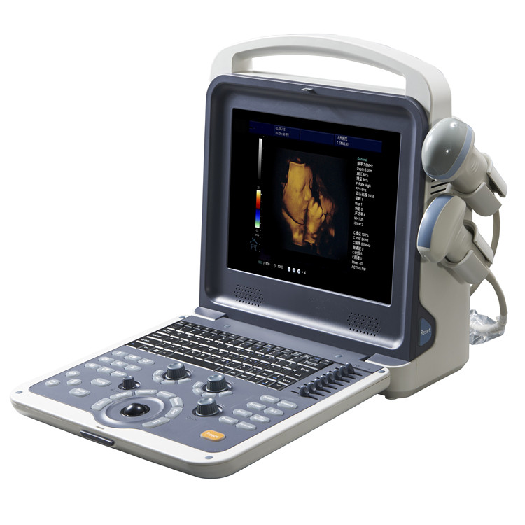 4D Color Digital Notebook Ultrasound System Scanner 4D Color Digital Notebook Ultrasound System Scanner
