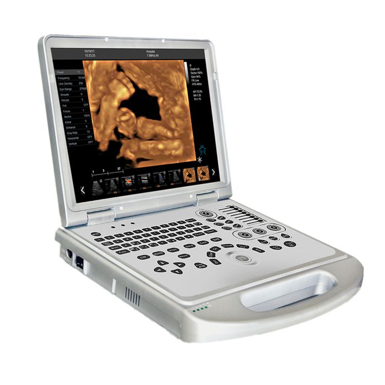 3D CW Ultrasound Equipment E Image Mode 3D CW Ultrasound Equipment E Image Mode