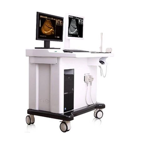 YJ-U60T B&W Trolley Utrasound Scanner with Workstation YJ-U60T B&W Trolley Utrasound Scanner with Workstation