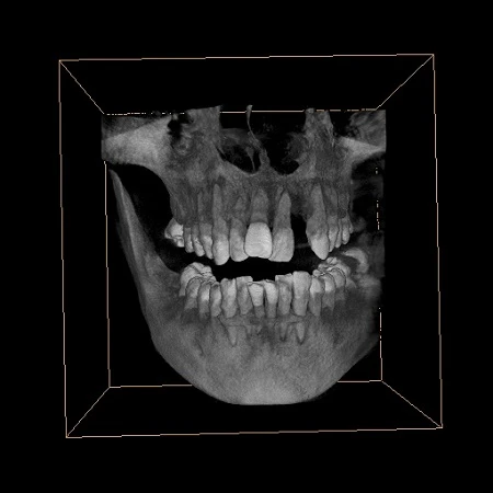 Panoramic Imaging Digital CBCT Dental system 3 Panoramic Imaging Digital CBCT Dental system 3