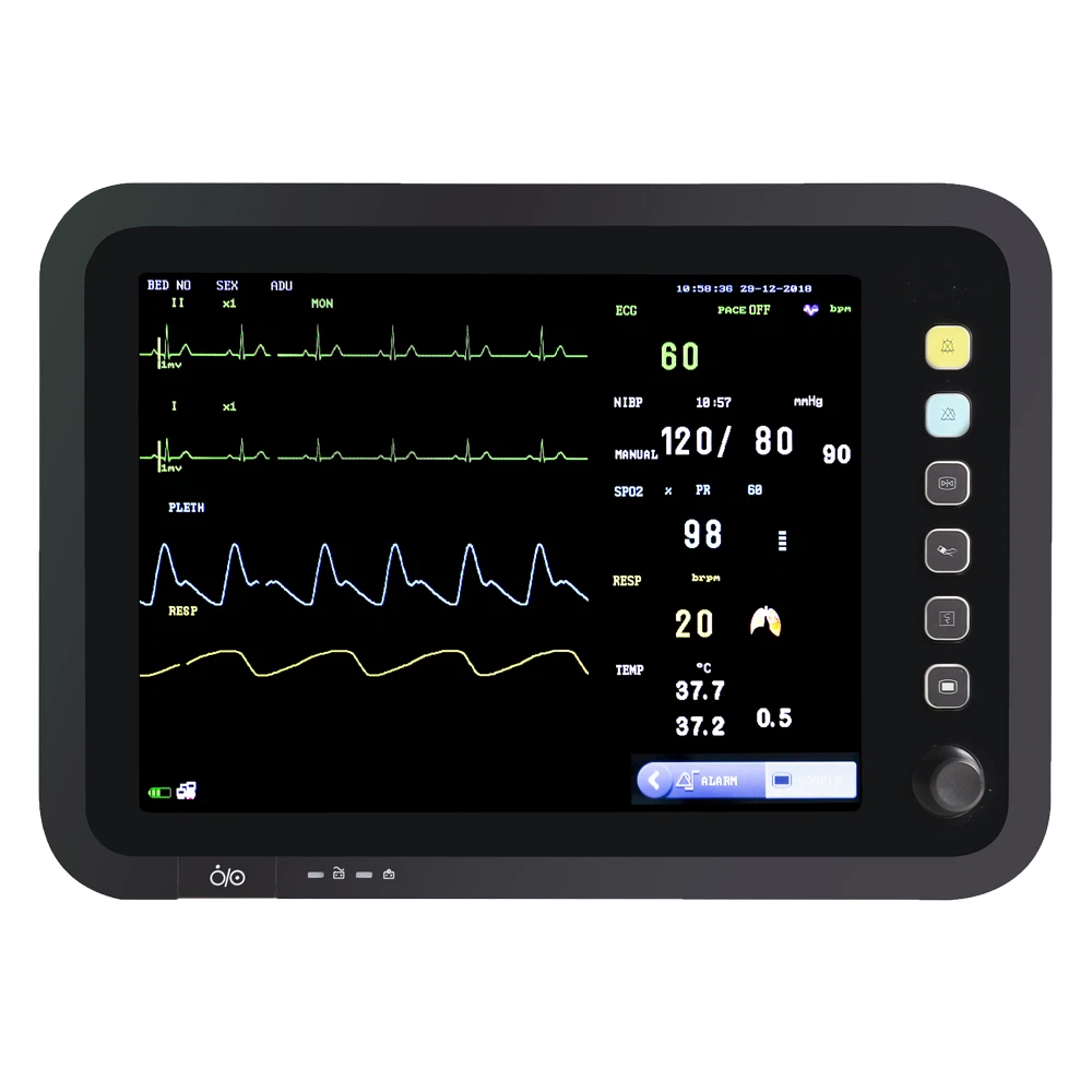 patient monitor