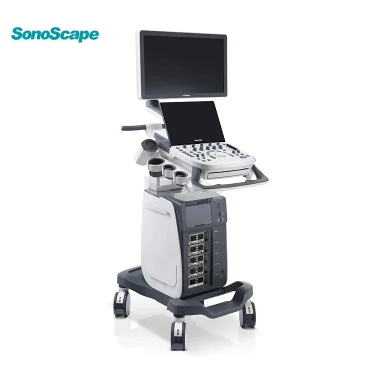 Sonoscape Ultrasound Sonoscape Ultrasound