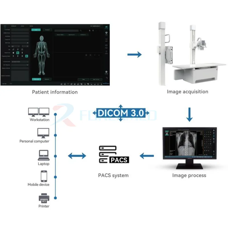 Digital Xray For Sale Digital Xray For Sale