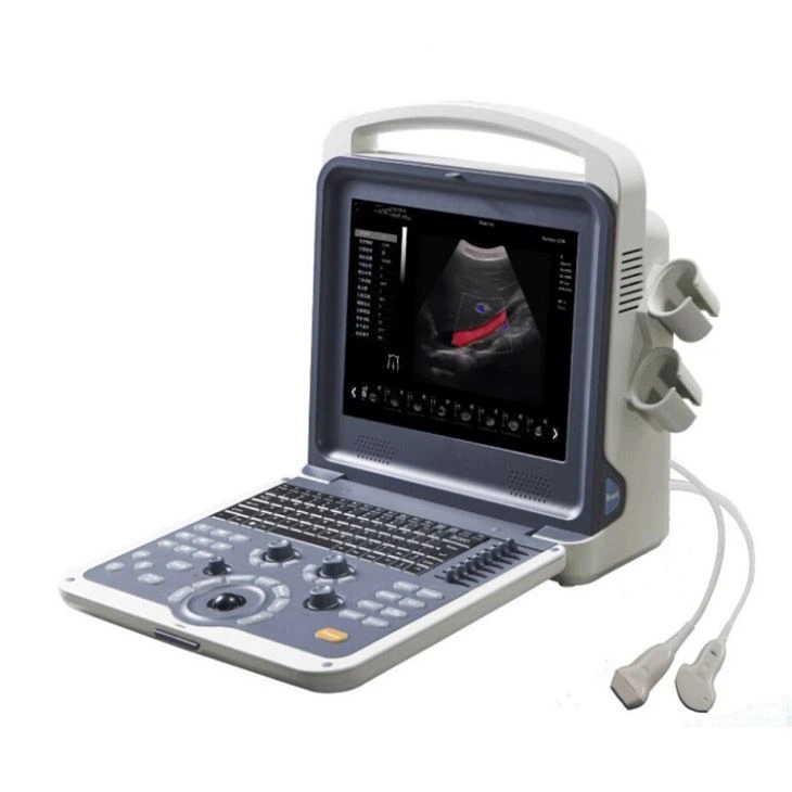 Sistema de Diagnóstico por Ultrasonido Doppler Color 4D