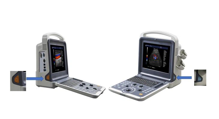 4D Color Doppler Ultrasound Diagnosis System 4D Color Doppler Ultrasound Diagnosis System