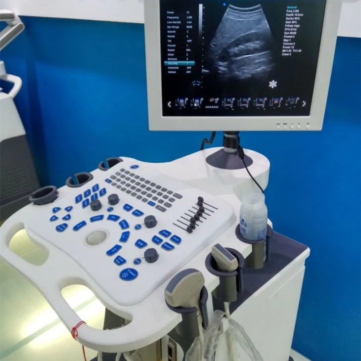 4D Portable Vascular Ultrasound Diagnostic Imaging Systems 4D Portable Vascular Ultrasound Diagnostic Imaging Systems