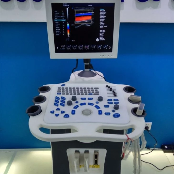 Visual Abortion Probe Ultrasound Scan Visual Abortion Probe Ultrasound Scan