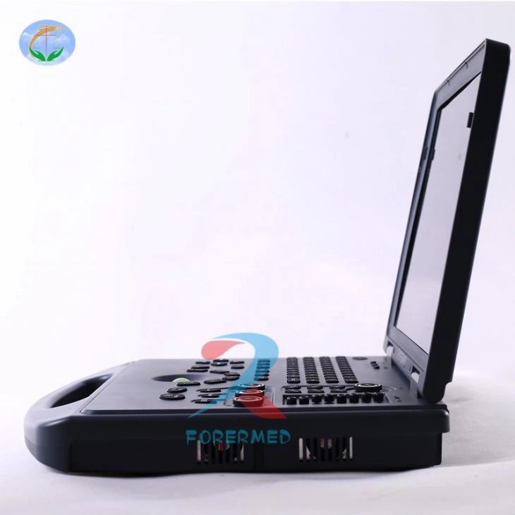 3D Doppler USG Scanner 3D Doppler USG Scanner