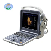 4D Baby Portable Medical Color Doppler Ultrasound Machine