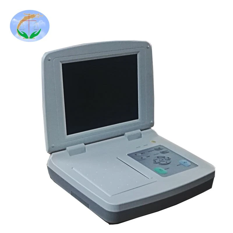 Monitores de ECG fetal