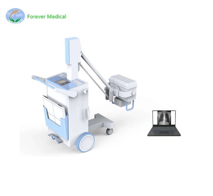 DIGITAL MOBILE X-RAY MACHINE DIGITAL MOBILE X-RAY MACHINE