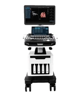 Ultrasonido Doppler color con carro 5D