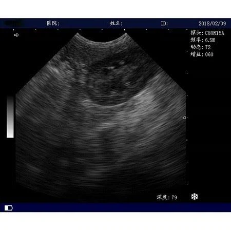 Black And White Full Digital Trolley Ultrasound Scanner Black And White Full Digital Trolley Ultrasound Scanner