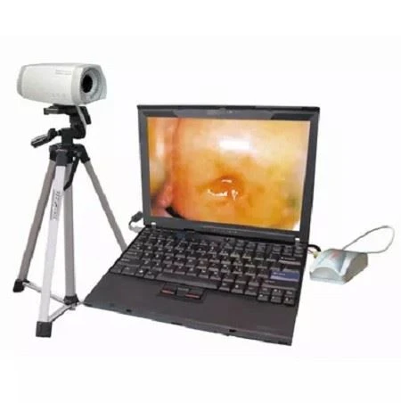 electronic dndoscope electronic dndoscope