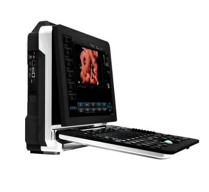 Portable 5d Color Doppler Ultrasound Portable 5d Color Doppler Ultrasound