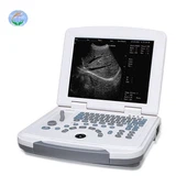 Escáner de máquina de ultrasonido USG para computadora portátil completamente digital para uso en clínicas y hospitales