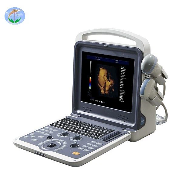 YJ-U60PLUS Color Doppler USG ——Sistema de diagnóstico por ultrasonido Doppler en color completamente digital