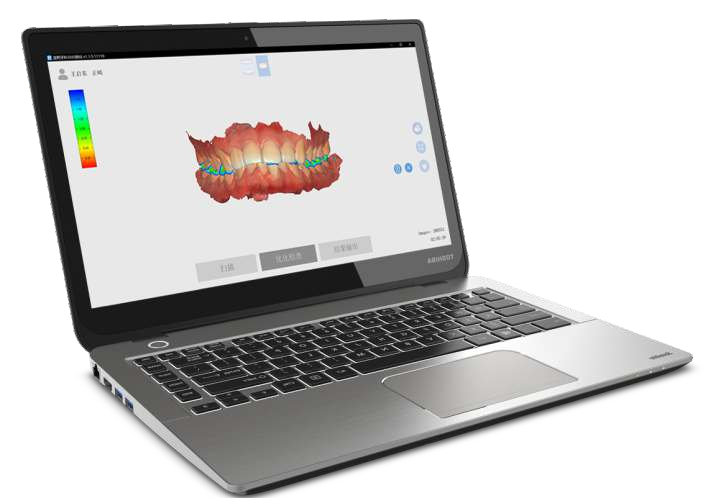 Portable Intraoral Scanner