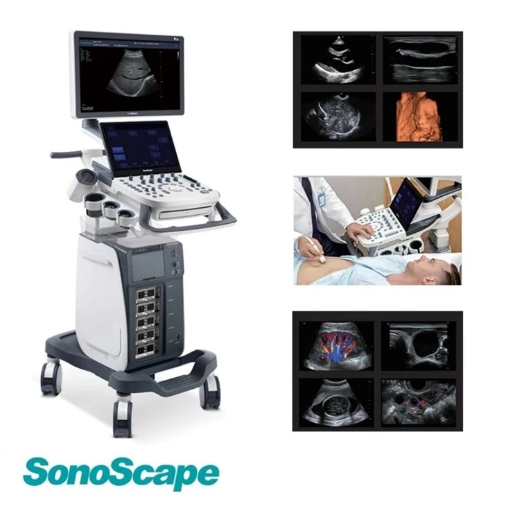 sonoscape ultrasound p15 sonoscape ultrasound p15
