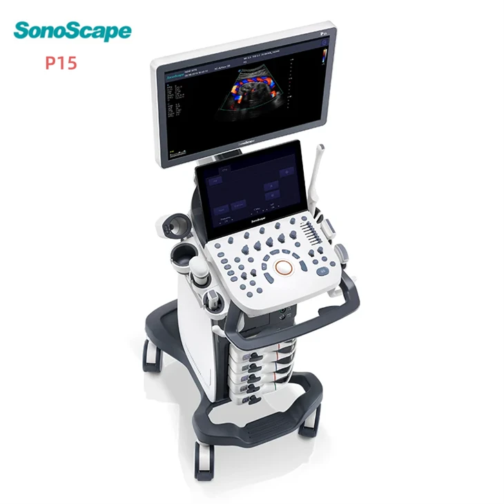 ultrasound ultrasound